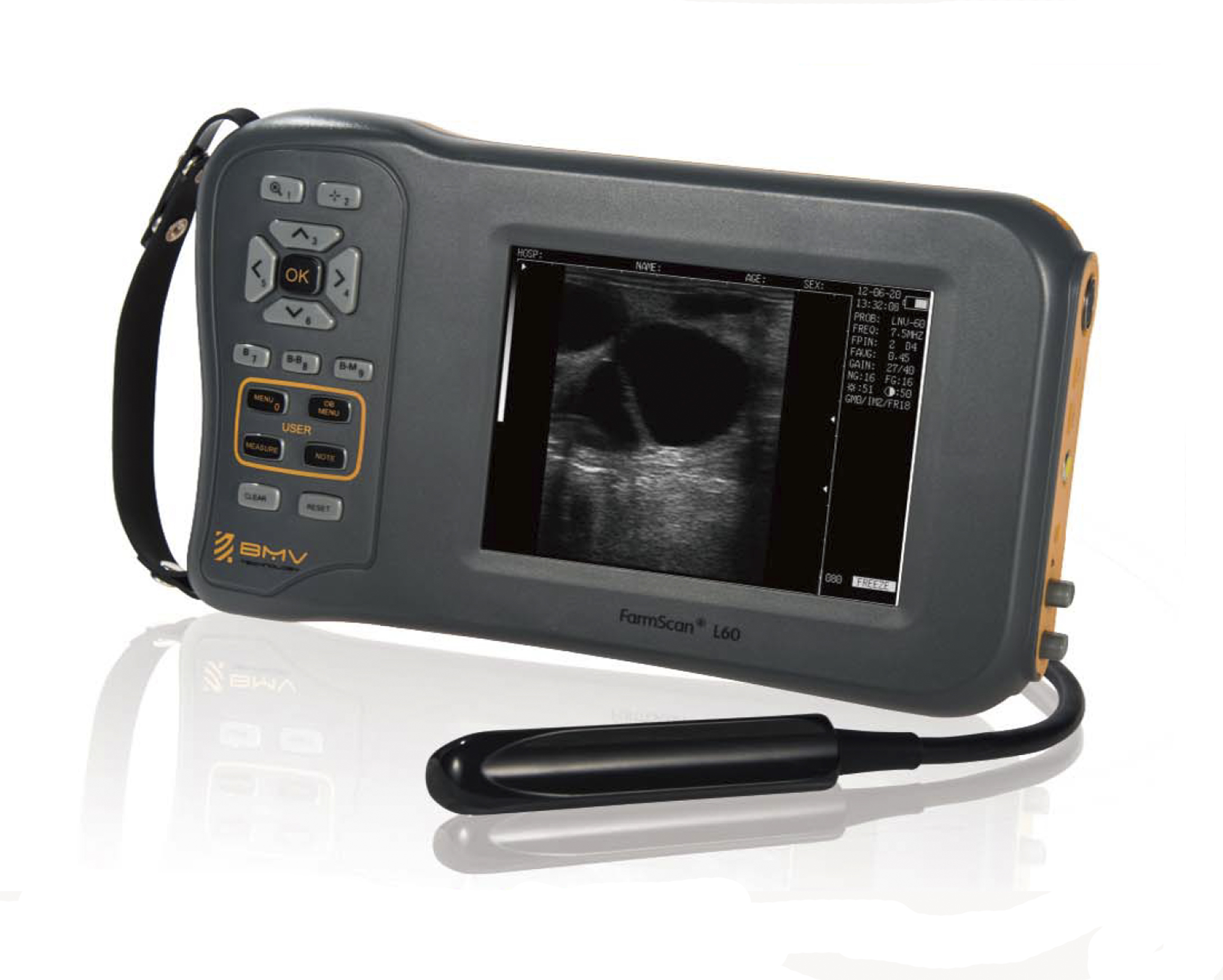 Ultrazvučni skener L60